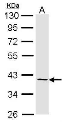 Western Blot: Fibromodulin/FMOD Antibody [NBP1-31657] - Sample (30 ug of whole cell lysate) A: Hep G2 10% SDS PAGE  diluted at 1:1000