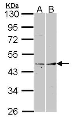 Western Blot: Fibromodulin/FMOD Antibody [NBP2-16494] - Sample (30 ug of whole cell lysate)  A: A431 B: Hela 10% SDS PAGE Fibromodulin antibody  diluted at 1:1000