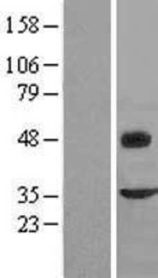 Western Blot: Fibromodulin Overexpression Lysate (Adult Normal) [NBL1-10778] Left-Empty vector transfected control cell lysate (HEK293 cell lysate); Right -Over-expression Lysate for Fibromodulin.