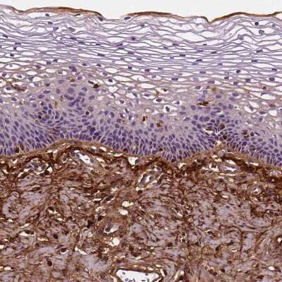 Immunohistochemistry-Paraffin: Fibulin 1 Antibody (CL0337) [NBP2-52918] - Staining of human uterine cervix shows strong positivity in the extracellular matrix.