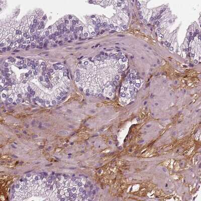 Immunohistochemistry-Paraffin: Fibulin 1 Antibody (CL0337) [NBP2-52918] - Staining of human prostate shows moderate positivity in the extracellular matrix.