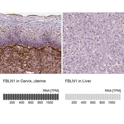 Immunohistochemistry-Paraffin: Fibulin 1 Antibody (CL0337) [NBP2-52918] - Staining in human cervix, uterine and liver tissues. Corresponding FBLN1 RNA-seq data are presented for the same tissues.