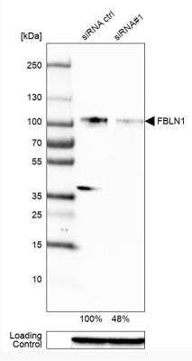 <b>Genetic Strategies Validation and Orthogonal Strategies Validation.</b>Western Blot: Fibulin 1 Antibody (CL0337) [NBP2-52918] - Analysis in RT-4 cells transfected with control siRNA, target specific siRNA probe #1, using Anti-FBLN1 antibody. Remaining relative intensity is presented. Loading control: Anti-GAPDH.