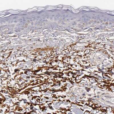 Immunohistochemistry-Paraffin: Fibulin 1 Antibody [NBP1-84725] - Staining of human skin shows strong positivity in extracellular matrix.