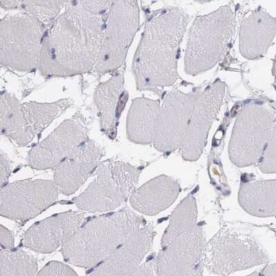 Immunohistochemistry-Paraffin: Fibulin 1 Antibody [NBP1-84725] - Staining of human skeletal muscle shows no positivity in myocytes as expected.