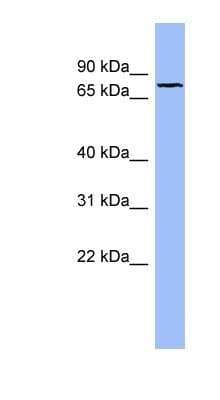 Western Blot: Fibulin 1 Antibody [NBP1-57911] - OVCAR-3 cell lysate, concentration 0.2-1 ug/ml.