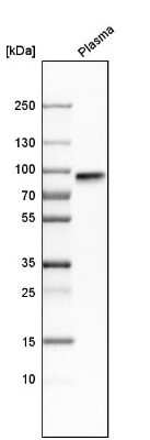 <b>Orthogonal Strategies Validation. </b>Western Blot: Fibulin 1 Antibody [NBP1-84726] - Analysis in human plasma.