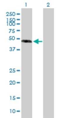 Western Blot: Fibulin-3/EFEMP1 Antibody [H00002202-B01P] - Analysis of EFEMP1 expression in transfected 293T cell line by EFEMP1 polyclonal antibody.  Lane 1: EFEMP1 transfected lysate(54.23 KDa). Lane 2: Non-transfected lysate.
