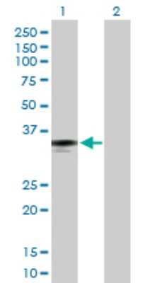 Western Blot: Ficolin-2 Antibody [H00002220-D01P] - Analysis of FCN2 expression in transfected 293T cell line by FCN2 polyclonal antibody.Lane 1: FCN2 transfected lysate(34.00 KDa).Lane 2: Non-transfected lysate.