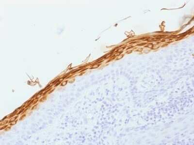 Immunohistochemistry-Paraffin: Filaggrin Antibody (FLG/1562) [NBP2-54362] - Formalin-fixed, paraffin-embedded human Skin stained with Filaggrin Monoclonal Antibody (FLG/1562).