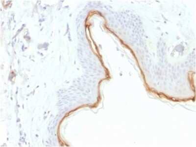 Immunohistochemistry-Paraffin: Filaggrin Antibody (FLG/1945) [NBP3-08355] - Formalin-fixed, paraffin-embedded human Skin stained with Filaggrin Mouse Monoclonal Antibody (FLG/1945).