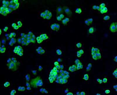 Immunocytochemistry/Immunofluorescence: Filamin A Antibody (SA30-08) [NBP2-67304] - Staining Filamin A in Ags cells (green). The nuclear counter stain is DAPI (blue). Cells were fixed in paraformaldehyde, permeabilised with 0.25% Triton X100/PBS.