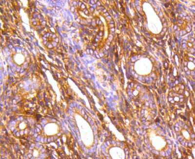 Immunohistochemistry-Paraffin: Filamin A Antibody (SA30-08) [NBP2-67304] - Analysis of paraffin-embedded mouse uterus tissue using anti-Filamin A antibody. Counter stained with hematoxylin.