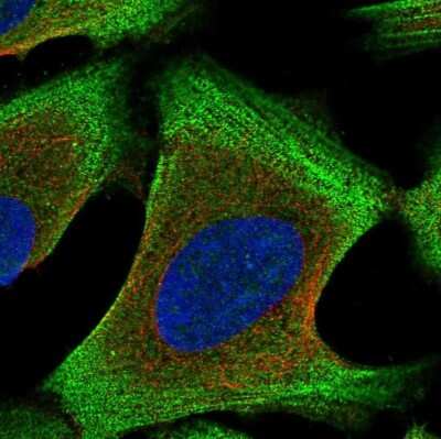 Immunocytochemistry/Immunofluorescence: Filamin A interacting protein 1 Antibody [NBP2-33686] - Staining of human cell line U-2 OS shows localization to plasma membrane & actin filaments.
