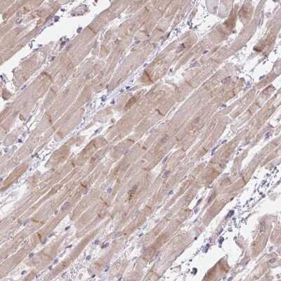 Immunohistochemistry: Filamin A interacting protein 1 Antibody [NBP2-33686] - Staining of human heart muscle shows moderate cytoplasmic and membranous positivity in myocytes.
