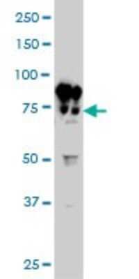 Western Blot: Filensin Antibody (6B4) [H00000631-M02] - BFSP1 monoclonal antibody (M02), clone 6B4 Analysis of BFSP1 expression in HL-60.