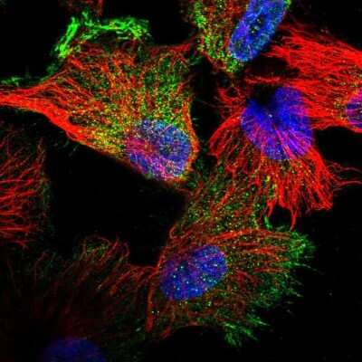Immunocytochemistry/Immunofluorescence: Filensin Antibody [NBP1-91902] - Immunofluorescent staining of human cell line U-251 MG shows localization to plasma membrane & cytosol.