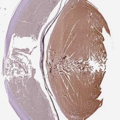 Immunohistochemistry-Paraffin: Filensin Antibody [NBP1-91902] - Staining of human eye shows moderate cytoplasmic positivity in the lens.