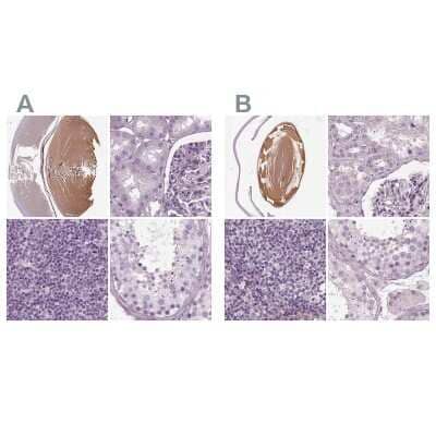 <b>Independent Antibodies Validation. </b>Immunohistochemistry-Paraffin: Filensin Antibody [NBP1-91902] - Staining of human eye, kidney, lymph node and testis using Anti-BFSP1 antibody NBP1-91902 (A) shows similar protein distribution across tissues to independent antibody NBP1-91903 (B).