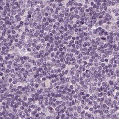 Immunohistochemistry-Paraffin: Filensin Antibody [NBP1-91902] - Staining of human lymph node.