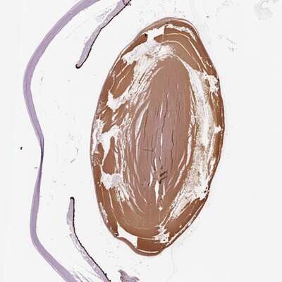 Immunohistochemistry-Paraffin: Filensin Antibody [NBP1-91903] - Staining of human eye shows strong positivity in the lens.