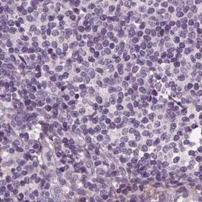Immunohistochemistry-Paraffin: Filensin Antibody [NBP1-91903] - Staining of human lymph node.