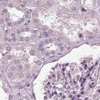 Immunohistochemistry-Paraffin: Filensin Antibody [NBP1-91903] - Staining of human kidney.