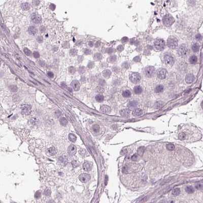 Immunohistochemistry-Paraffin: Filensin Antibody [NBP1-91903] - Staining of human testis.