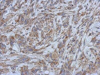 Immunohistochemistry-Paraffin: Filensin Antibody [NBP2-16497] -  U373 xenograft, using Filensin antibody at 1:500 dilution.  Antigen Retrieval: Trilogy™ (EDTA based, pH 8.0) buffer, 15min.