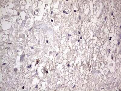 Immunohistochemistry: Filensin Antibody (OTI2B2) - Azide and BSA Free [NBP2-70249] - Analysis of Human bladder tissue.