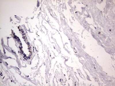 Immunohistochemistry: Filensin Antibody (OTI2B2) - Azide and BSA Free [NBP2-70249] - Analysis of Human breast tissue.