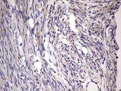 Immunohistochemistry: Filensin Antibody (OTI2B2) - Azide and BSA Free [NBP2-70249] - Analysis of Human endometrium tissue.