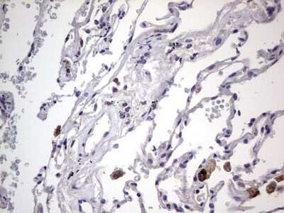Immunohistochemistry: Filensin Antibody (OTI2B2) - Azide and BSA Free [NBP2-70249] - Analysis of Human lung tissue.