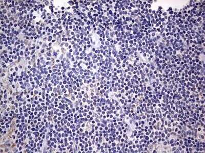 Immunohistochemistry: Filensin Antibody (OTI2B2) - Azide and BSA Free [NBP2-70249] - Analysis of Human lymphoma tissue.
