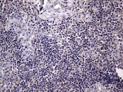 Immunohistochemistry: Filensin Antibody (OTI2B2) - Azide and BSA Free [NBP2-70249] - Analysis of Human tonsil tissue.