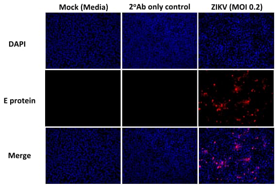 Immunocytochemistry/Immunofluorescence: Flavivirus group antigen Antibody (D1-4G2-4-15 (4G2)) - Chimeric [NBP2-52666] - Detection of Zika virus. Immunofluorescence images of Vero cells infected with ZIKV after 30h infection as well as controls. Cells were fixed in 4% PFA for 30 min at RT. Primary antibody (Rabbit IgG) staining was performed in 0.3% Triton X-100 at 1:20 dilution overnight at 4C, detected using a Goat Anti-Rabbit IgG (1:500) for 1h at RT and counterstained with DAPI.