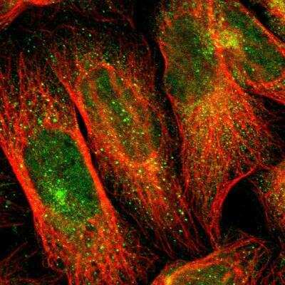 Immunocytochemistry/Immunofluorescence: Flightless I Antibody [NBP1-87926] - Staining of human cell line U-2 OS shows positivity in cytoplasm, microtubule organizing center and  nucleus but excluded from the nucleoli.