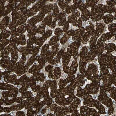 Immunohistochemistry-Paraffin: Flightless I Antibody [NBP1-87925] - Staining of human liver shows strong cytoplasmic positivity in hepatocytes.