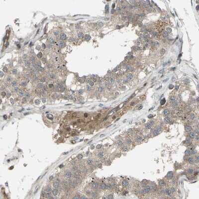 Immunohistochemistry-Paraffin: Flightless I Antibody [NBP1-87925] - Staining of human testis shows moderate cytoplasmic positivity in Leydig cells.