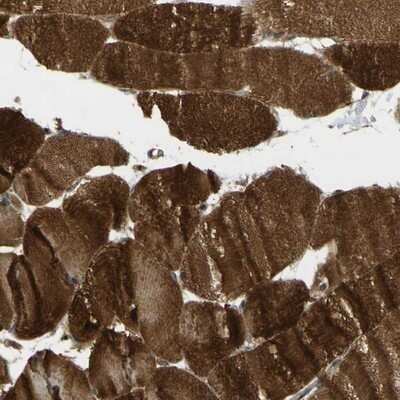 Immunohistochemistry-Paraffin: Flightless I Antibody [NBP1-87926] - Staining of human skeletal muscle shows strong cytoplasmic positivity in myocytes.