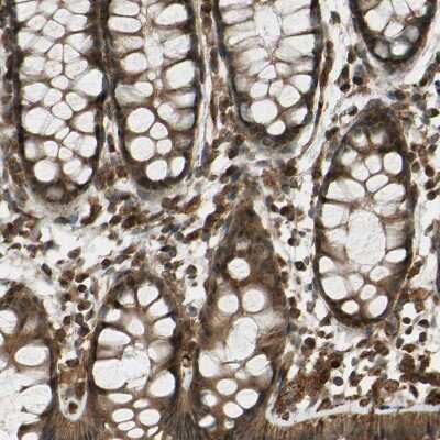 Immunohistochemistry-Paraffin: Flightless I Antibody [NBP1-87926] - Staining of human gastrointestinal shows strong cytoplasmic positivity in glandular cells.