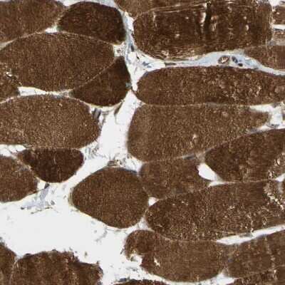 Immunohistochemistry-Paraffin: Flightless I Antibody [NBP1-87926] - Staining of human skeletal muscle shows strong cytoplasmic positivity in myocytes.