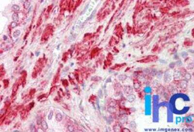 Immunohistochemistry-Paraffin: Flightless I Antibody [NBP2-24584] - Formalin-fixed, paraffin-embedded human prostate probed with FLII antibody at 5 ug/ml.    Staining of formalin-fixed tissues is enhanced by boiling tissue sections in 10 mM sodium citrate buffer, pH 6.0 for 10-20 min followed by cooling at RT for 20 min.