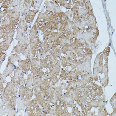 Immunohistochemistry-Paraffin: Flightless I Antibody [NBP3-03712] - Paraffin-embedded rat heart using Flightless I antibody at dilution of 1:100 (40x lens).