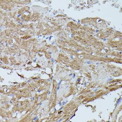 Immunohistochemistry-Paraffin: Flightless I Antibody [NBP3-03712] - Paraffin-embedded mouse heart using Flightless I antibody at dilution of 1:100 (40x lens).