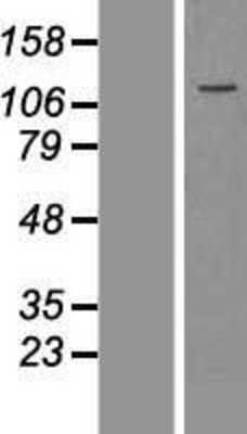 Western Blot: Flightless I Overexpression Lysate (Adult Normal) [NBP2-10791] Left-Empty vector transfected control cell lysate (HEK293 cell lysate); Right -Over-expression Lysate for Flightless I.