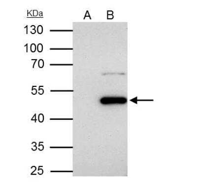 Immunoprecipitation: Flotillin-1 Antibody [NBP2-16508] - IP samples: HCT-116 whole cell extract A. Control with 4 ug of preimmune Rabbit IgG B. Immunoprecipitation of Flotillin 1 protein by 4 ug Flotillin 1 antibody [C3], C-term 10 % SDS-PAGE The immunoprecipitated Flotillin 1 protein was detected by Flotillin 1 antibody [C3], C-term diluted at 1:1000. [EasyBlot anti-rabbit IgG was used as a secondary reagent]