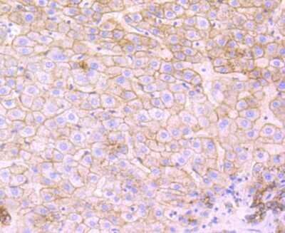 Immunohistochemistry-Paraffin: Flotillin-1 Antibody (JB19-45) [NBP2-75492] - Analysis of paraffin-embedded human liver tissue using anti-Flotillin 1 antibody. Counter stained with hematoxylin.