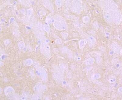 Immunohistochemistry-Paraffin: Flotillin-1 Antibody (JB19-45) [NBP2-75492] - Analysis of paraffin-embedded rat brain tissue using anti-Flotillin 1 antibody. Counter stained with hematoxylin.