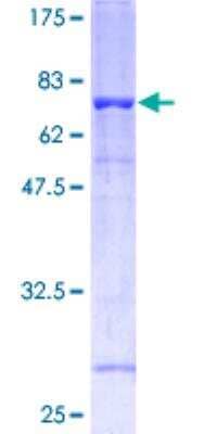 SDS-Page: Recombinant Human Flotillin-1 Protein [H00010211-P01]